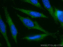 Stathmin 1 Rabbit Recombinant Antibody, Proteintech:Antibodies:Primary