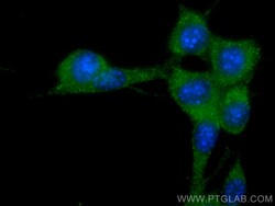 Stathmin 1 Rabbit Recombinant Antibody, Proteintech:Antibodies:Primary