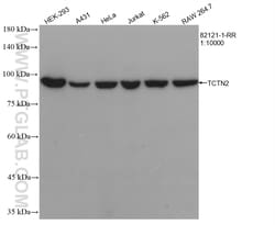 TCTN2 Rabbit Recombinant Antibody, Proteintech:Antibodies:Primary Antibodies