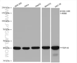 TDP-43 (C-terminal) Rabbit Recombinant Antibody, Proteintech:Antibodies:Primary