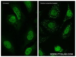 TIA1 Rabbit Recombinant Antibody, Proteintech:Antibodies:Primary Antibodies