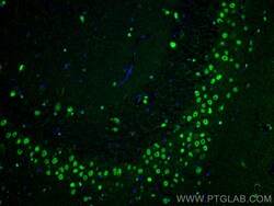 VCP Rabbit Recombinant Antibody, Proteintech Unconjugated; 20 &mu;L:Antibodies,