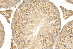 WT1 Rabbit Recombinant Antibody, Proteintech Unconjugated; 100 &mu;L:Antibodies,