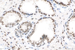 androgen receptor Rabbit Recombinant Antibody, Proteintech Unconjugated;