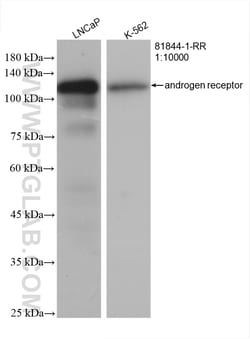 androgen receptor Rabbit Recombinant Antibody, Proteintech Unconjugated;