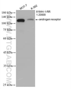 androgen receptor Rabbit Recombinant Antibody, Proteintech Unconjugated;