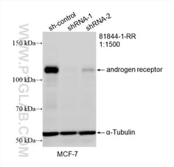 androgen receptor Rabbit Recombinant Antibody, Proteintech Unconjugated;