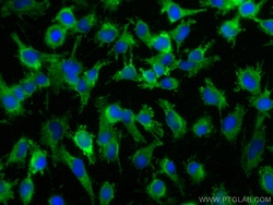 calcyphosine Mouse Monoclonal Antibody, Proteintech:Antibodies:Primary