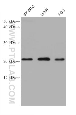 calcyphosine Mouse Monoclonal Antibody, Proteintech:Antibodies:Primary