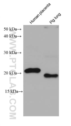 calcyphosine Mouse Monoclonal Antibody, Proteintech:Antibodies:Primary