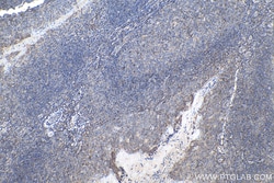 cyclin B1 Mouse Monoclonal Antibody, Proteintech Unconjugated; 20 &mu;L:Antibodies,