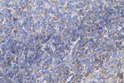 cyclin B1 Mouse Monoclonal Antibody, Proteintech Unconjugated; 20 &mu;L:Antibodies,