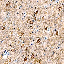 Human 17 beta-HSD1/HSD17B1 Antibody, R D Systems 25&mu;g; Unlabeled:Antibodies,