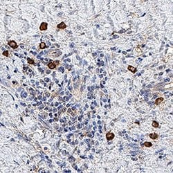 Human 20S Immunoproteasome Antibody, R D Systems:Antibodies:Primary Antibodies