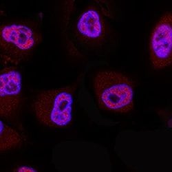 Human 20S Proteasome Antibody, R D Systems:Antibodies:Primary Antibodies