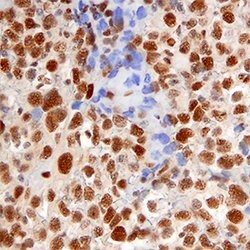 Human 53BP1 Antibody, R D Systems 25&mu;g; Unlabeled:Antibodies, Monoclonal
