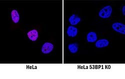 Human 53BP1 Antibody, R D Systems 25&mu;g; Unlabeled:Antibodies, Monoclonal