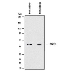 Human AGTR-1 Antibody, R D Systems 25 &mu;g; Unconjugated:Antibodies, Monoclonal