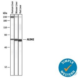 Human/Mouse/Rat ALDH2 Antibody, R D Systems:Antibodies:Primary Antibodies