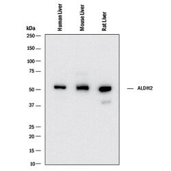 Human/Mouse/Rat ALDH2 Antibody, R D Systems:Antibodies:Primary Antibodies