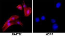 Human ALK/CD246 Antibody, R D Systems 100 &mu;g | Buy Online | R&D Systems | Fisher Scientific