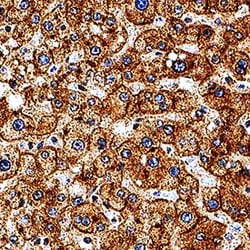 Human ASGR1/ASGPR1 Antibody, R D Systems:Antibodies:Primary Antibodies