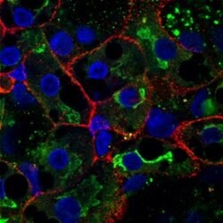 Human ASGR1/ASGPR1 Antibody, R D Systems 100&mu;g; Unlabeled:Antibodies,