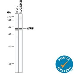 Human ATRIP Antibody, R D Systems 100&mu;g; Unlabeled:Antikörper
