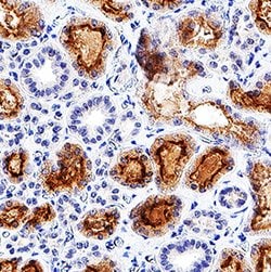 Human Adrenomedullin/ADM Antibody, R D Systems:Antibodies:Primary Antibodies