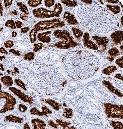 Human Aminopeptidase N/CD13 Antibody, R D Systems:Antibodies:Primary Antibodies