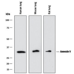 Human/Mouse/Rat Annexin V Antibody, R D Systems 100&mu;g; Unlabeled:Antibodies,