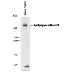 Human Apolipoprotein B/ApoB Antibody, R D Systems 100&mu;g; Unlabeled:Antibodies,
