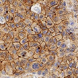 Human Apolipoprotein B/ApoB Antibody, R D Systems 100ug; Unlabeled:Antibodies,