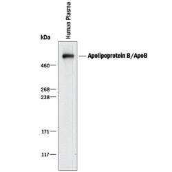 Human Apolipoprotein B/ApoB Antibody, R D Systems 100ug; Unlabeled:Antibodies,