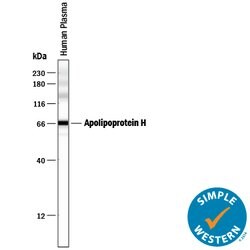 Human Apolipoprotein H/ApoH Antibody, R D Systems 25&mu;g; Unlabeled:Antibodies,