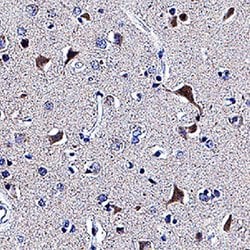 Human beta-1,3-Glucuronyltransferase 1/B3GAT1 Antibody, R D Systems:Antibodies:Primary