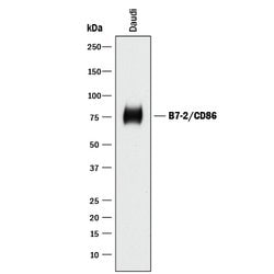 Human B7-2/CD86 Antibody, R D Systems 25&mu;g; Unlabeled:Antibodies, Polyclonal