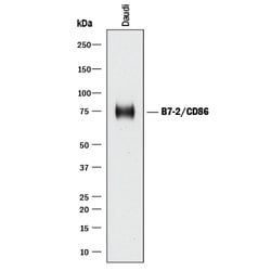 Human B7-2/CD86 Antibody, R D Systems 500&mu;g; Unlabeled:Antibodies, Monoclonal
