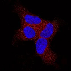 Human BAK Antibody, R D Systems 25&mu;g; Unlabeled:Antibodies, Polyclonal