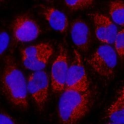 Human BNIP3 Antibody, R D Systems:Antibodies:Primary Antibodies