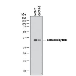 Human Betacellulin/BTC Antibody, R D Systems 100&mu;g; Unlabeled:Antibodies,