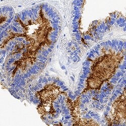 Human CA125/MUC16 Antibody, R D Systems 25&mu;g:Antibodies, Monoclonal