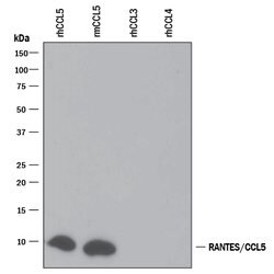 Human CCL5/RANTES Antibody, R D Systems 25&mu;g; Unlabeled:Antibodies,