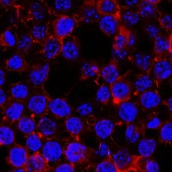 Mouse CCR2 Antibody, R D Systems 25 &mu;g; Unconjugated:Antibodies, Monoclonal