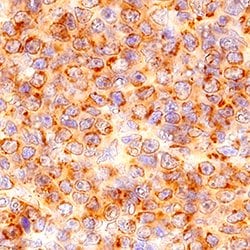 Human CCR6 Antibody, R D Systems 100&mu;g:Antibodies, Monoclonal