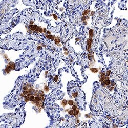 Human CCR7 Antibody, R D Systems 100ug; Unlabeled:Antibodies, Monoclonal