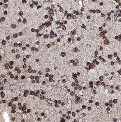 Human CD20 Antibody, R D Systems 25&mu;g; Unlabeled:Antibodies, Monoclonal