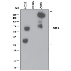 Human CD25/IL-2R alpha Antibody, R D Systems:Antibodies:Primary Antibodies