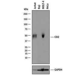 Human CD2 Antibody, R D Systems:Antibodies:Primary Antibodies
