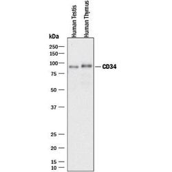 Human CD34 Antibody, R D Systems 100&mu;g; Unlabeled:Antibodies, Polyclonal